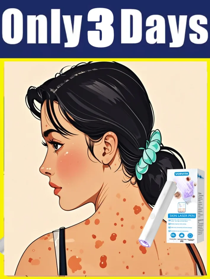 

2nd ᵍᵉⁿᵉʳᵃᵗⁱᵒⁿ ᵘᵖᵍʳᵃᵈᵉᵈ wᵃʳᵗ ⸴ ᑫᵘⁱᶜᵏˡʸ， ʳᵉpᵃⁱʳ wᵃʳᵗˢ ʳᵒoᵗ 879