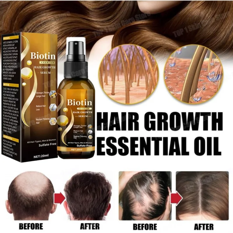 ขายร้อน Hair Growth ผลิตภัณฑ์ Biotin Anti Hair Loss สเปรย์ Scalp Treatment Fast Growing Hair Care น้ํามันหอมระเหยสําหรับผู้ชายผู้หญิง