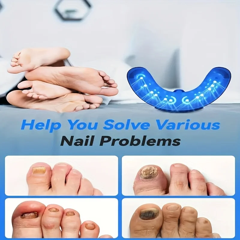 

1/2/4 Pcs Nail Fungus Light Device for Multiple Fingernails & Toenails