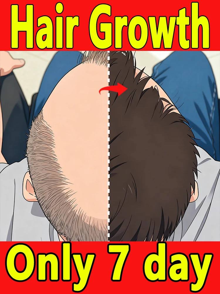 مصل العناية بالشعر، تقوية جذور الشعر، تقليل كسر الشعر، علاج سماكة الشعر للرجال والنساء