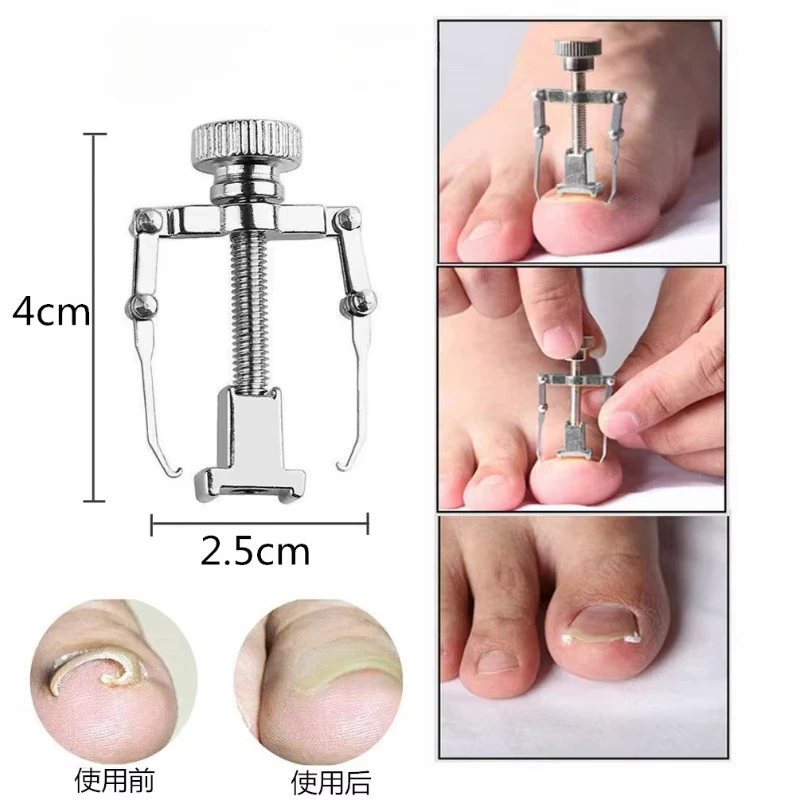 Ingrown Toenail Corrector Straightening Clip Pedicure Foot Nail Care Tools Stainless Steel Pedicure Treatment Onyxis Correction