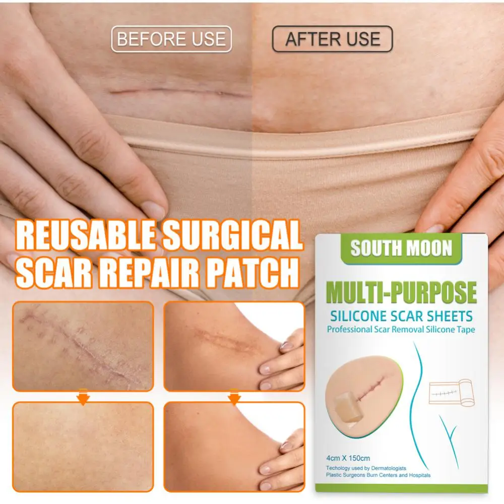 Waterproof Stretch Mark Scar Removal Sheets -grade Top-rated Comfortable Trending Burn Skin Efficient Healing