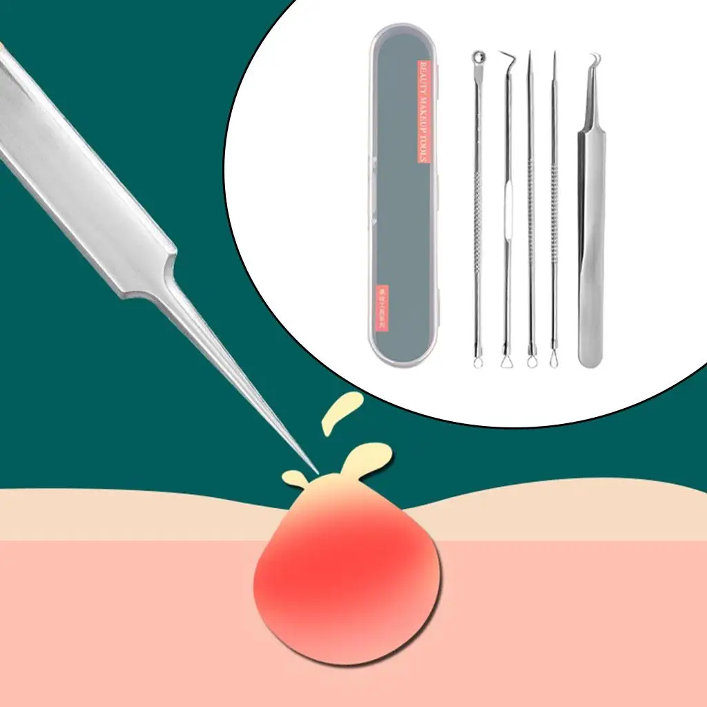 2-4 opakowanie zestawu do usuwania zaskórników na trądzik Extractio do usuwania zaskórników