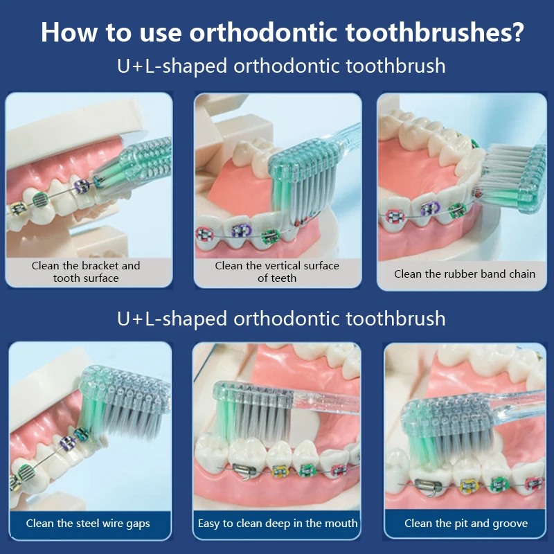 Tandenborstel Orthodontische Tandenborstel Drie In Één Set Orthodontische Tanden Gap Borstel Tandklem Schoonmaken Zachte Borstelige Tandenborstel