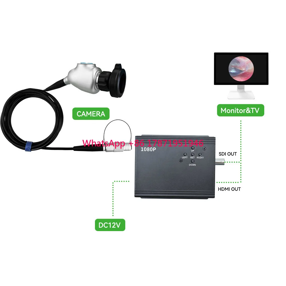 Portable Full HD Endoscope Medical Camera System For Pet ENT Surgery