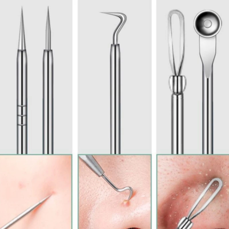 5/6 Stuks Rvs Acne Naalden Mobiele Pincet Mee-eter Verwijderen Gereedschap Porie Reiniging Gereedschap Professionele Gezicht Huidverzorging gereedschap