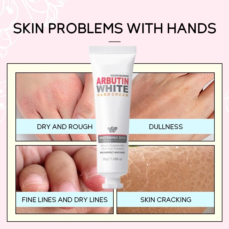 Niacinamide Arbutin Hand Cream Whitening Wrinkle Removal Anti-crack Moisturizing Repair Fade Fine Lines Smooth Skin Hand Care