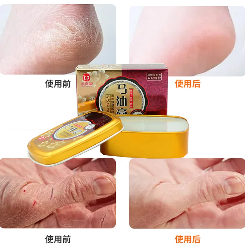 Jintai Kangma Oil Cream for Hand and Foot Cracks Moisturizing and Moisturizing Cream for Hand Cracks and Foot Cracks Skin care