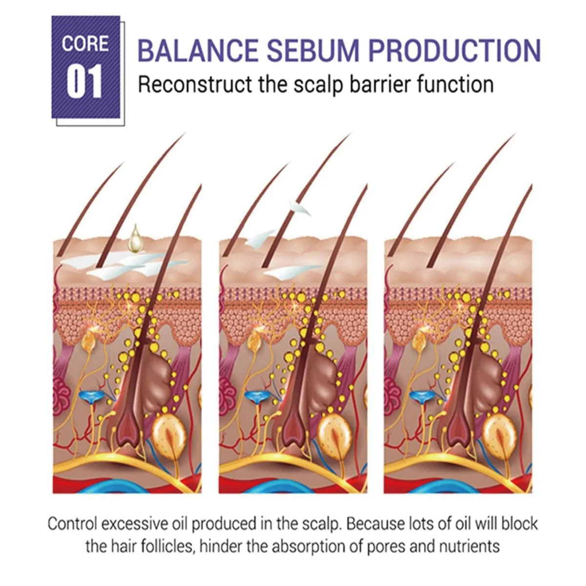 Suavizar o couro cabeludo reparação danificado crescimento do cabelo óleos essenciais essência produtos de cuidados perda de cabelo restaurar cabelo denso mais grosso soro líquido