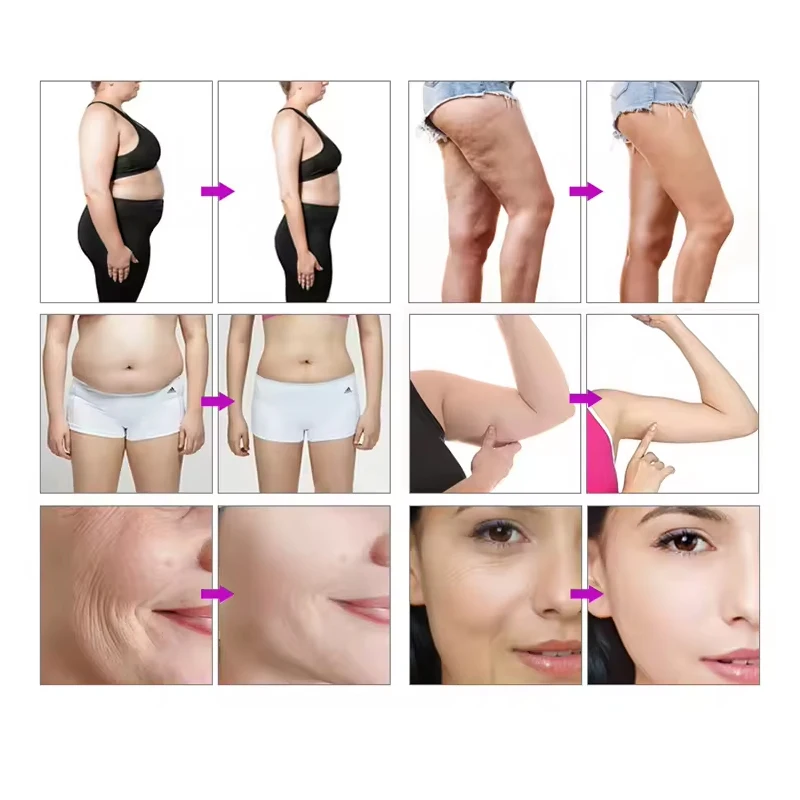 6 in 1 High Quality 80k / 40k Vacuum Cavitation System Body Shaping Cavitation Slimming Machine 80k with 6 EMS Pads