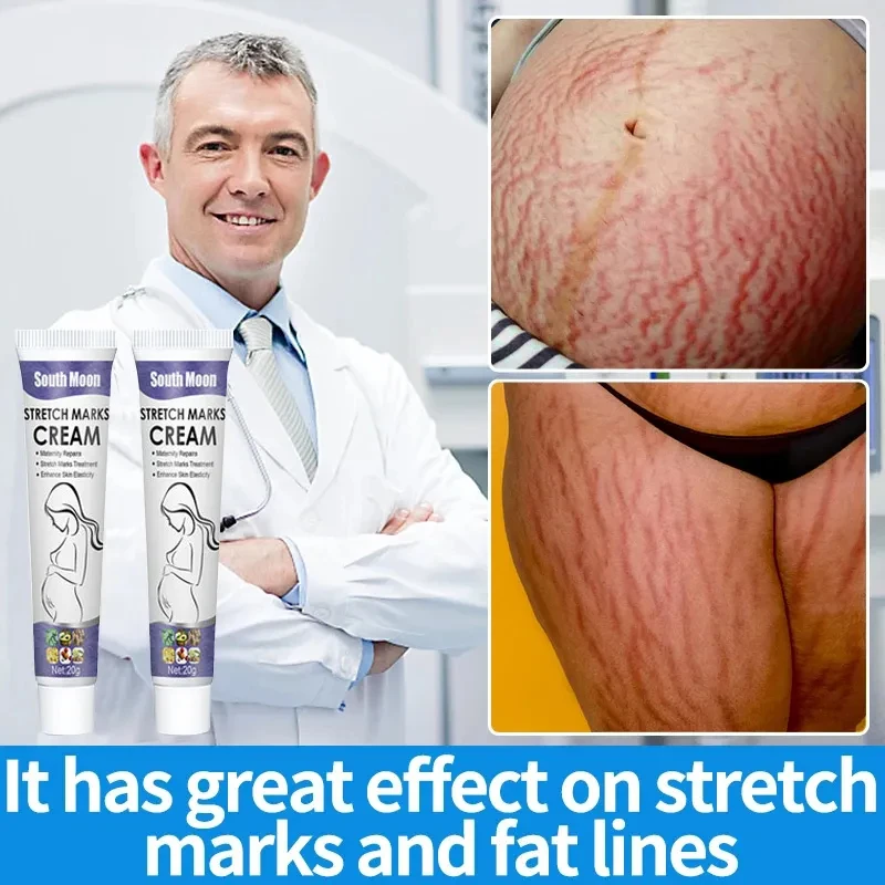 Stretch Marks Permanent Removal Cream Eliminate Body Belly Stretch Marks Swelling Marks Remove Skin Cracks