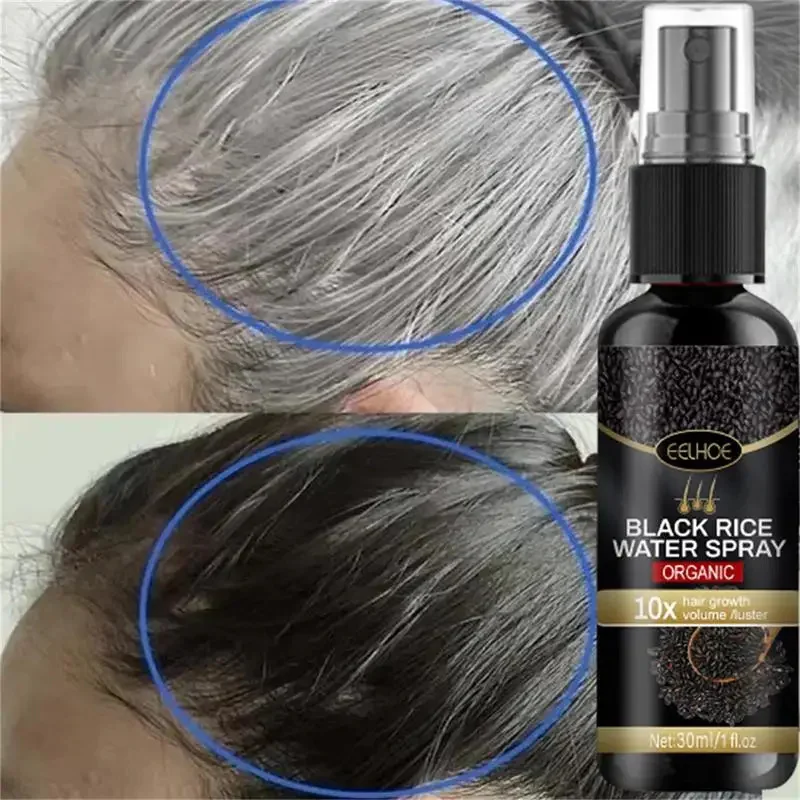 

Black Rice Grayish White Hair Care Essence Spray Firm Hair Dense Moisturizing Repairing Hair Root Hair Growth Care Products