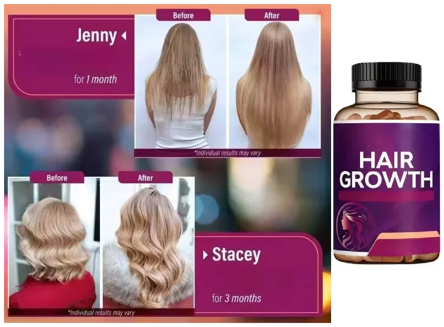 Stunning Improvement, Replacing Flat Hair with Fluffy Hair Volume