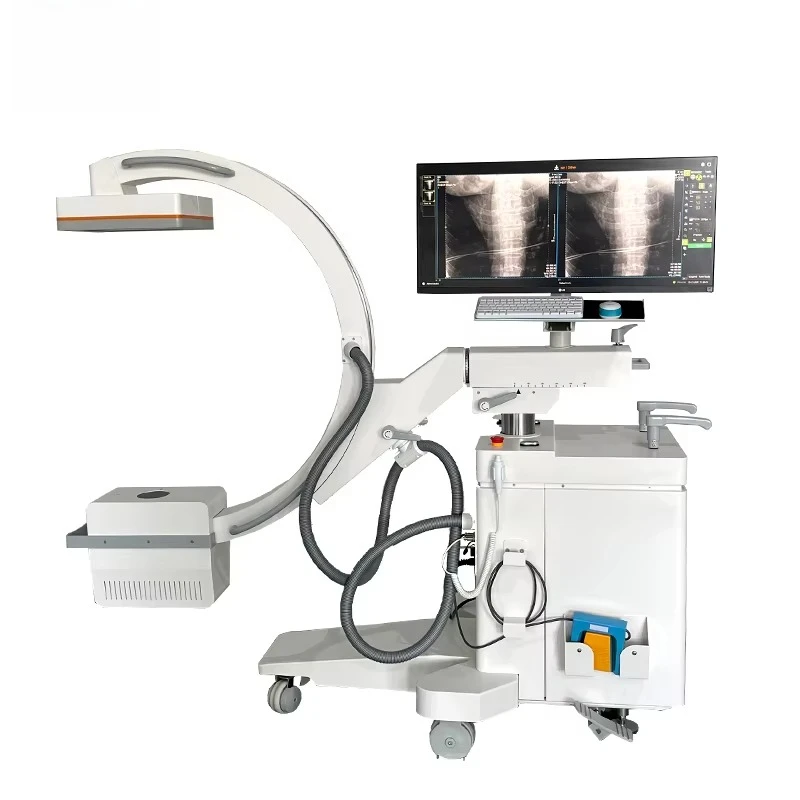 High-frequency mobile C-arm X-ray machine digital transmission imaging  surgical imaging system