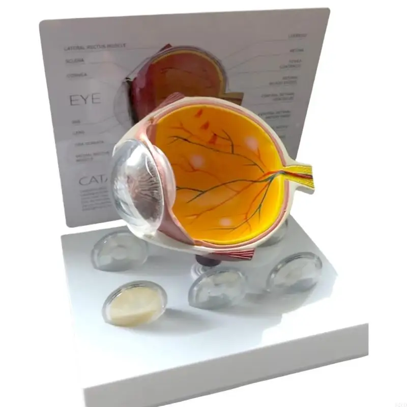 

Human Anatomical Eye Model Pathological Eyeball Anatomy Model for Teaching Tool Drop Shipping