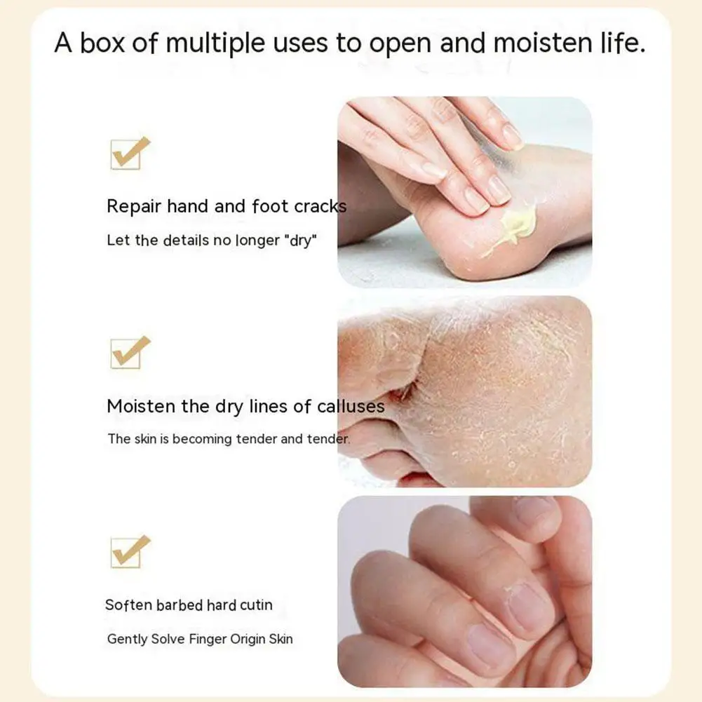 20g Anti-Drying Crack Foot Cream Heel Cracked Repair Cream Removal Dead Skin Hand Feet Care For Cracked Hands Foot Spa