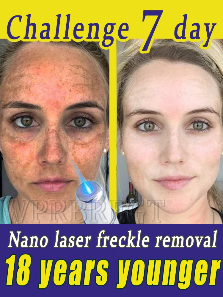 〔Hot sale〕Effectively solve the problem of ᴘɪɢᴍᴇɴᴛ ᴀᴄᴄᴜᴍᴜʟᴀᴛɪᴏɴ and say goodbye to pigmentation