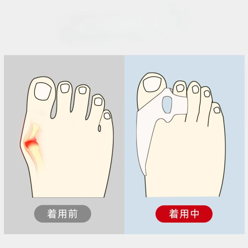 2pcs Silicone Gel Thumb Corrector Bunion Foot Toe Hallux Valgus Protector Separator Finger Straightener Adjuster Foot Care Tool
