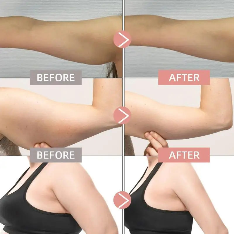 30 ชิ้น/กล่อง Body Care Patch Management แพทช์สุขภาพความงามเครื่องมือ