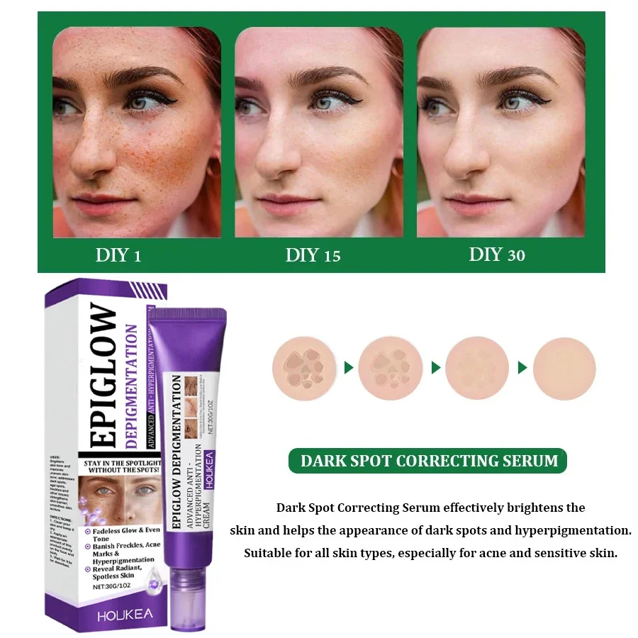 Dark Spots Removal Cream Facial Whitening Freckle Acne Mark Pigmentation Removal Melanin Skin Correction Brighten Care Products - Image 5