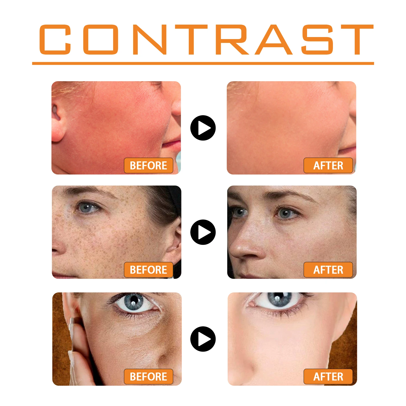 كريم وقاية من الشمس للجسم والوجه من Ouhoe SPF 100 حماية من الأشعة فوق البنفسجية فوق البنفسجية UVB مانع غير دهني للاستخدام اليومي في الصيف في الهواء الطلق على الشاطئ 50 جرام #4