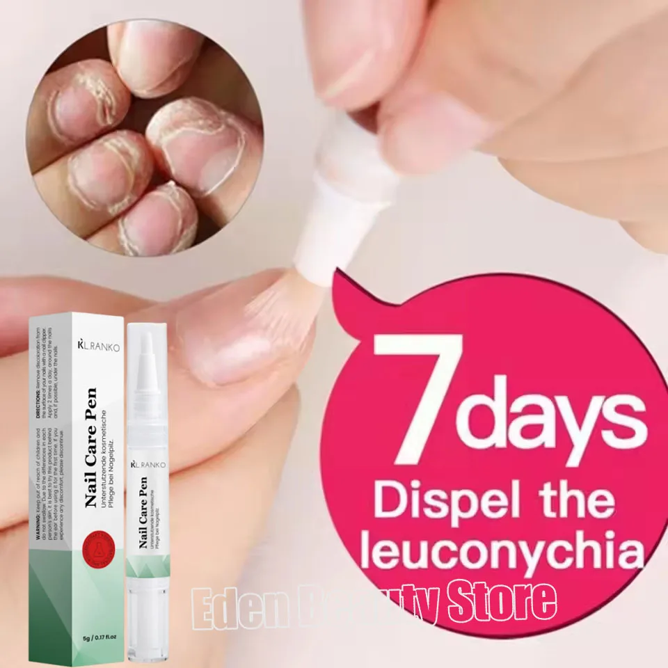 

Nail Fungal Treatment Serum Foot Toe Nail Fungus Removal Essential Oil Anti Infection Onychomycosis Paronychia Repairing Care