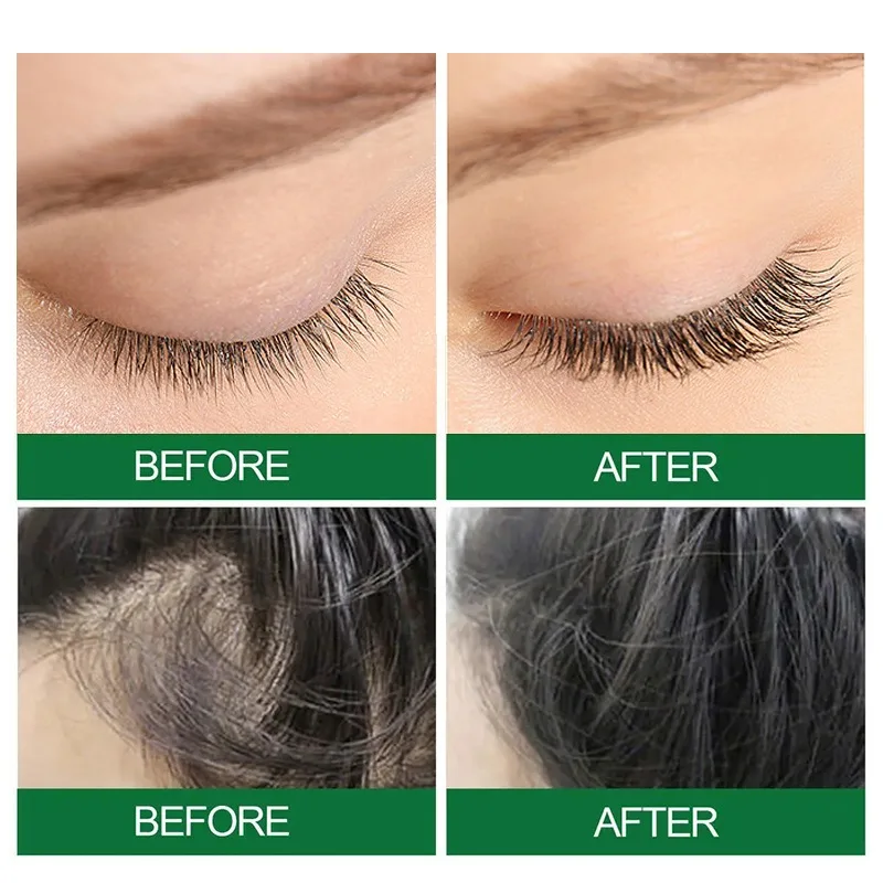 Huile de ricin noir jamaïcain huile essentielle de Massage d'huile de ricin noir jamaïcain biologique naturelle