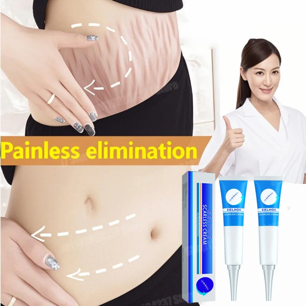 

Fast Absorption Stretch Marks Cream Remove Old Marks Firming Skin For Pregnancy Postpartum Use