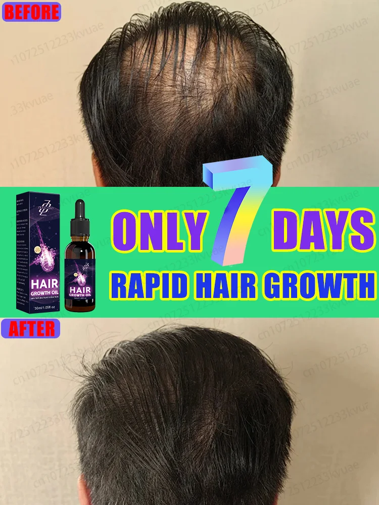 

Activate hair follicles to make hair grow quickly, giving you a brand new look in just seven days