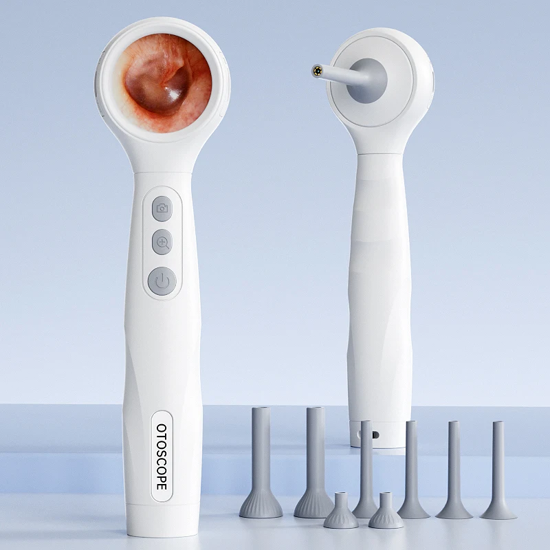 

Портативный умный визуальный отоскоп с IPS-экраном 1,38 дюйма, ультратонкий, 4,2 мм, камера 1080P для чистки ушей, осмотра носа, рта и кожи