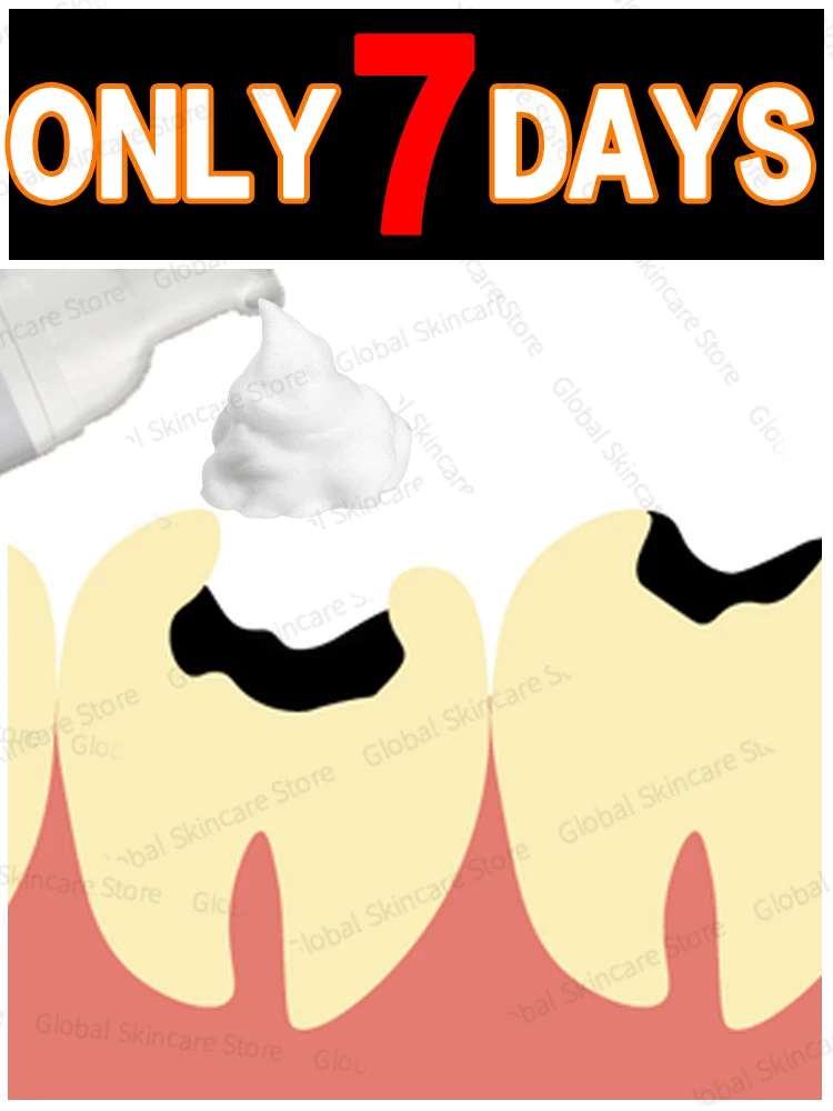 2025 أداة العناية بالفم موس تنظيف الفم #1