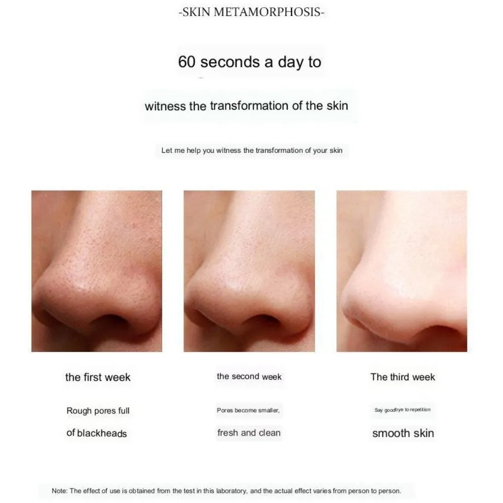 Visuele elektrische mee-eter verwijderaar Poriereiniger Vergrootglas Gezichtsmee-eter verwijderingsinstrument Acne Remover LED