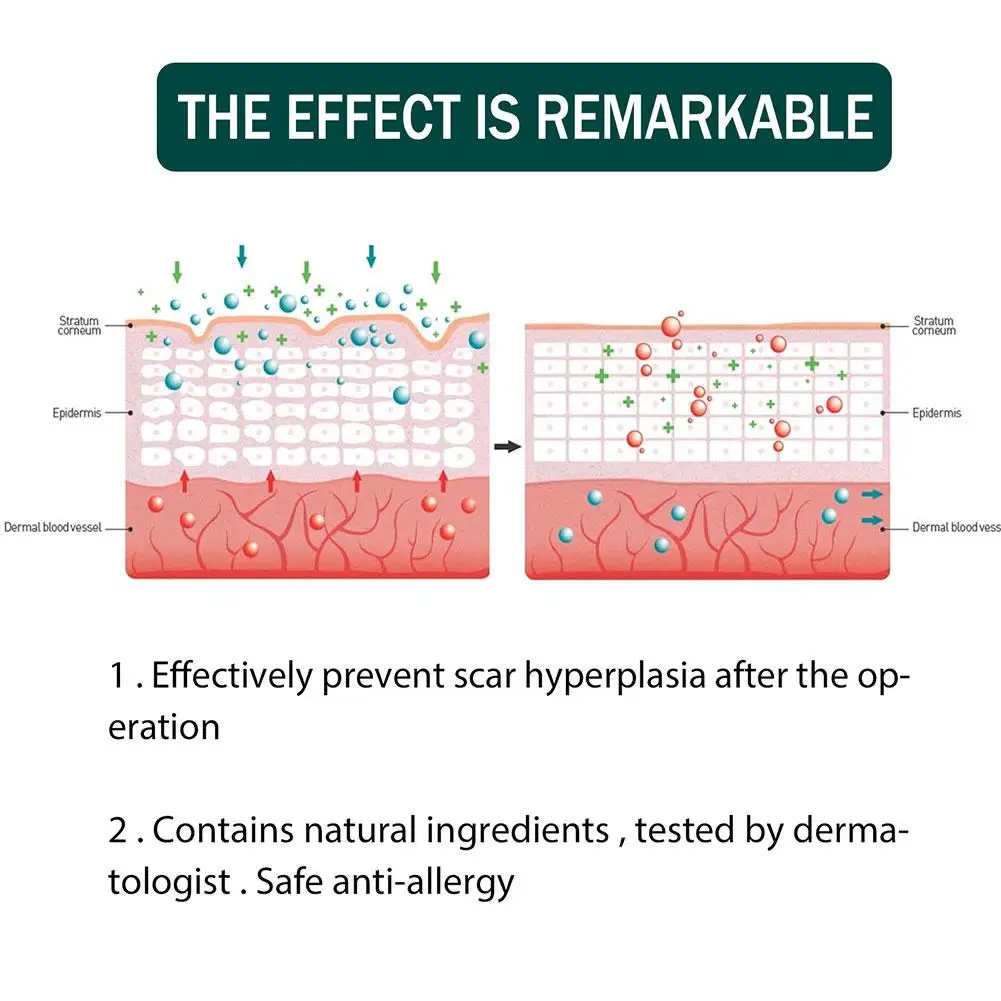 1 rotolo di fogli di cicatrici in Silicone per la riparazione della pelle rimozione della toppa per la rimozione del nastro adesivo per smagliature Patch per terapia brucia la cura della pelle della cicatrice dell'acne