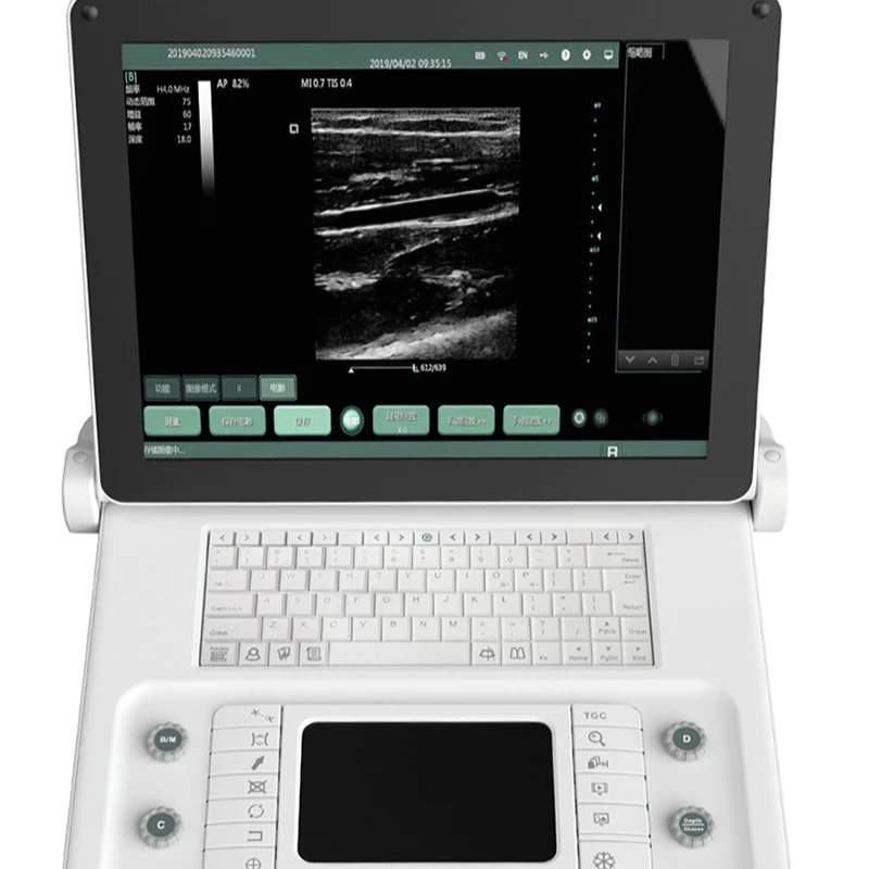 SS-8B B/W Laptop ultrasound System