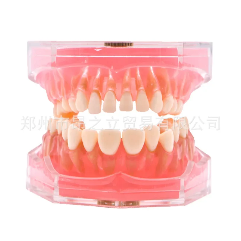 2022 Various Dental Model Teeth Teaching Model Study Removable Orthodontic Implant Tooth Models Resin Dentistry Dentist Material