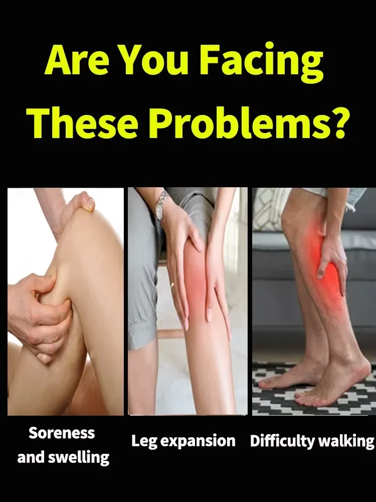 Generation-2 Laser Says Goodbye To Spider Legs Varicose In 7 Days