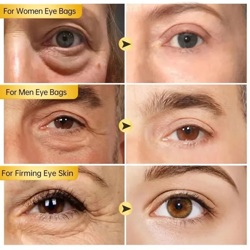 حقيبة العين الفورية إزالة كريم عين جزيئات الدهون الهالات السوداء الانتفاخ تتلاشى الخطوط الدقيقة رفع سطع الجمال الكوري العناية بالعين #2