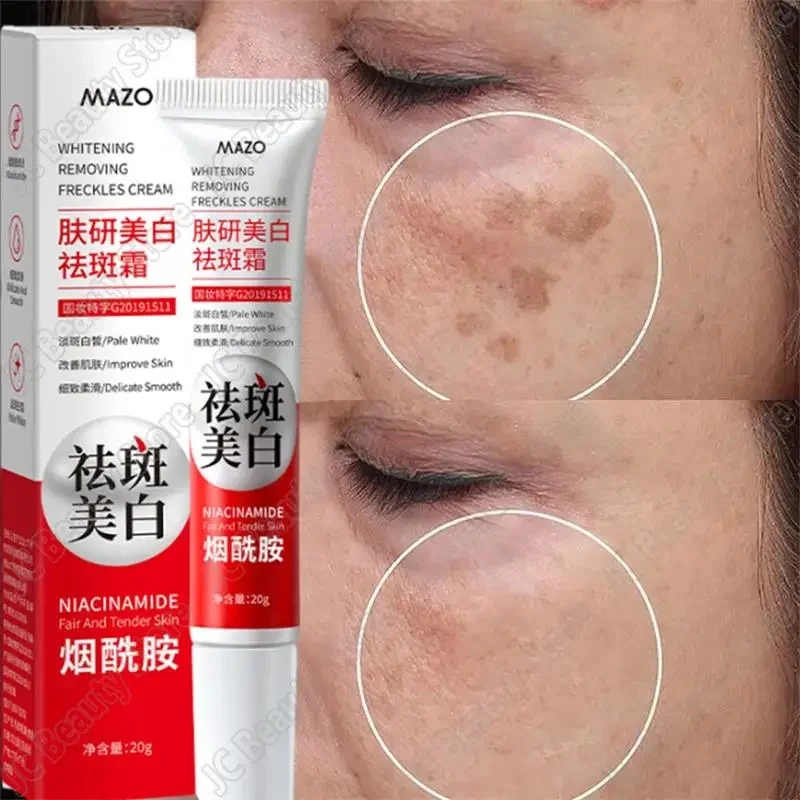 

Effective Whitening Freckle Face Cream Remove Dark Spots Fade Melasma Melanin Moisturizing Brighten Improve Dullness Skin Care