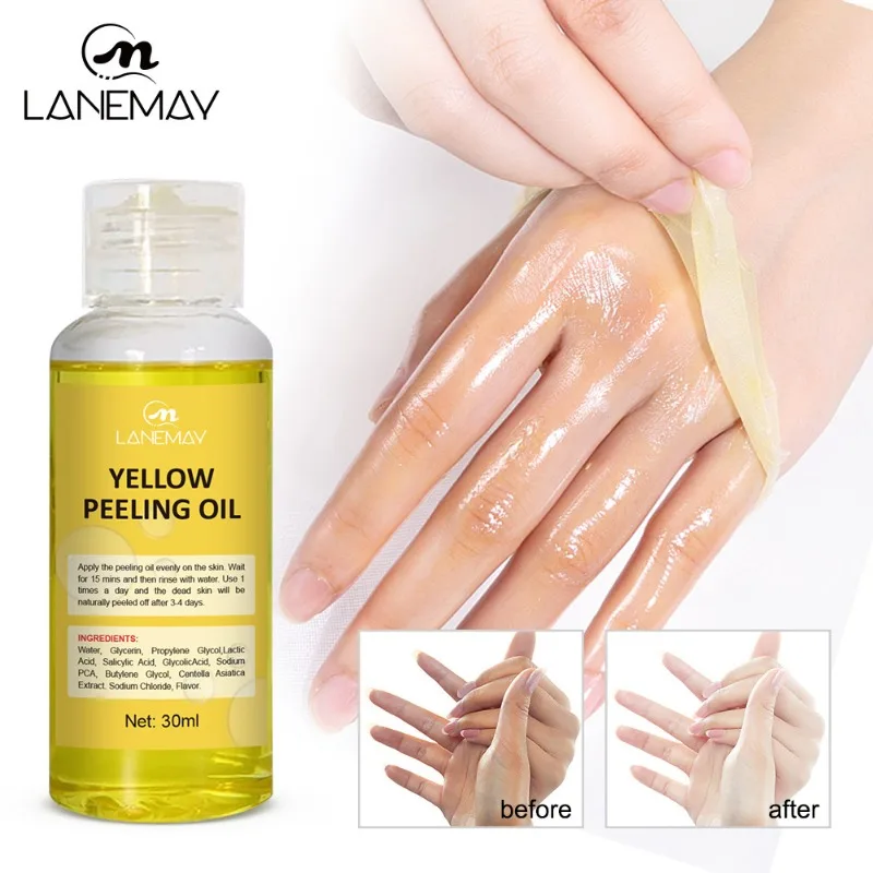

Strong Yellow Peeling Oil Bleach Dark Skin Whiten Lotion Lighten Body Elbow Knee Hand Exfoliate Dead Skin Brightening Skin Tone