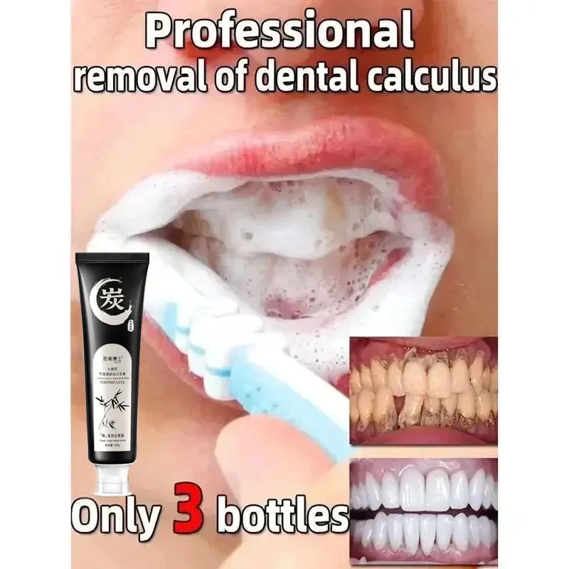 Dental Calculus Remover Whitening Removal Bad Breath Teeth Toothpaste Brightening Preventing Periodontitis Dental Cleansing Care