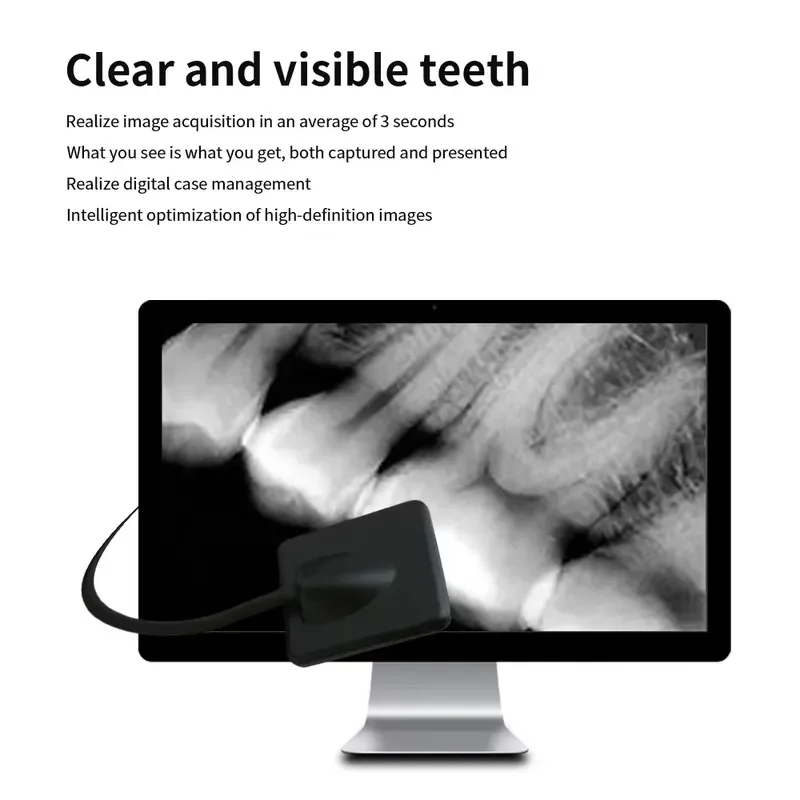 Hot Sale Equipment Portable Digital X-ray Sensor Intraoral Imaging System Unit High Definition Image RVG Sensor