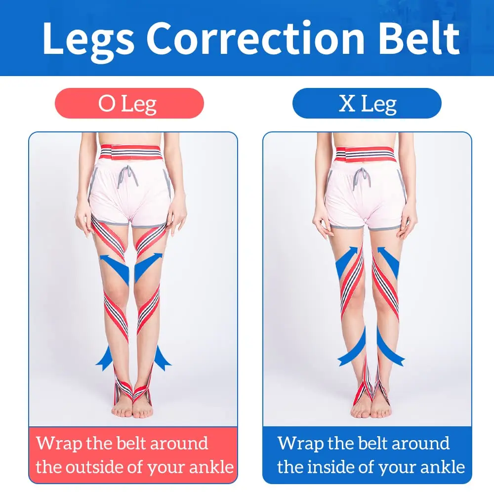 O / X Legs Correction Belt Legs Posture Corrector Band Unisex Pediatric Belt for Men Women and Children for Day and Night