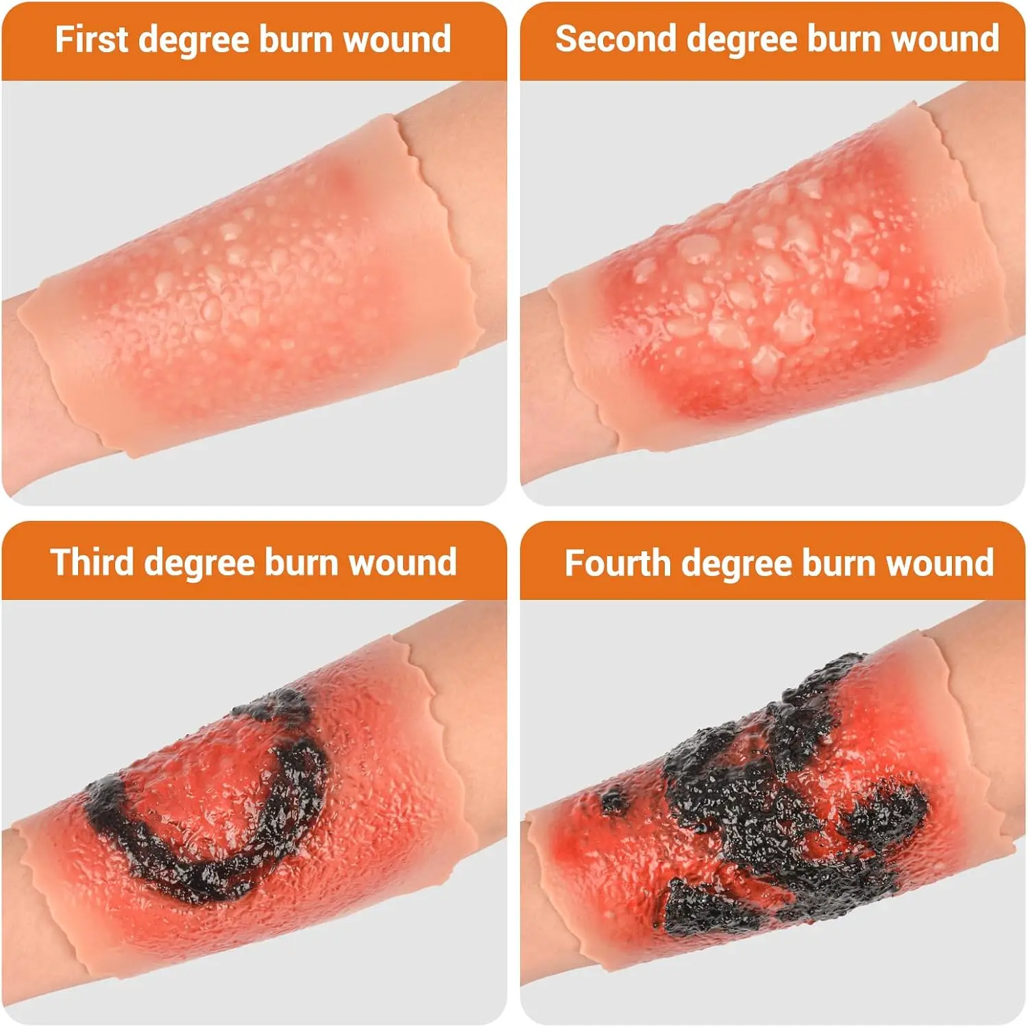 Adhesive Burn Wound Model Set First to Fourth Degree Wound Care Packing Training for First Aid Medical Student Educate Practice