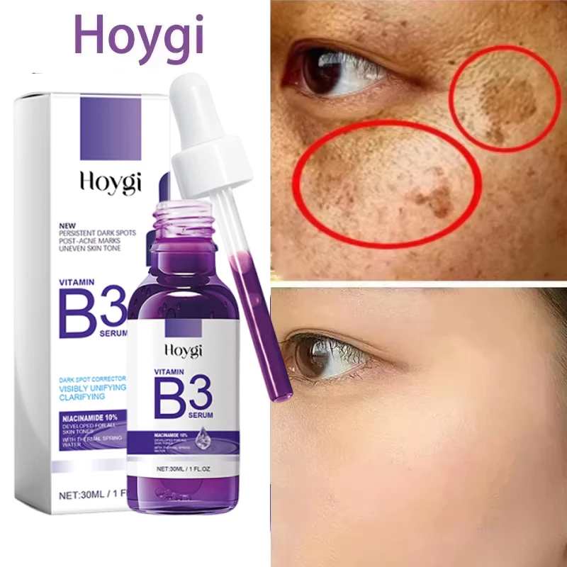 

Vitamin B3 Face Serum Fade Dark Spot Chloasma Lighten Melanin Pigmentation Smooth Pores Brighten Moisturizing Skin Care Essence