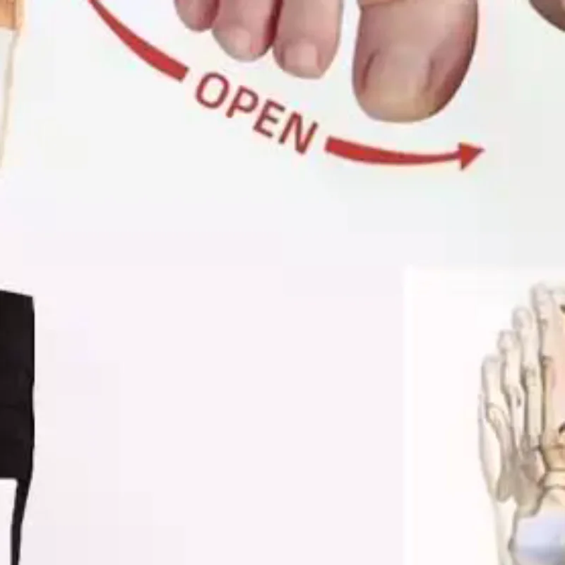 

Регулируемый корректор для вальгусной деформации стопы, разделитель пальцев, ортопедические вкладыши, выпрямитель для большого пальца, инструменты для педикюра и ухода за ногами