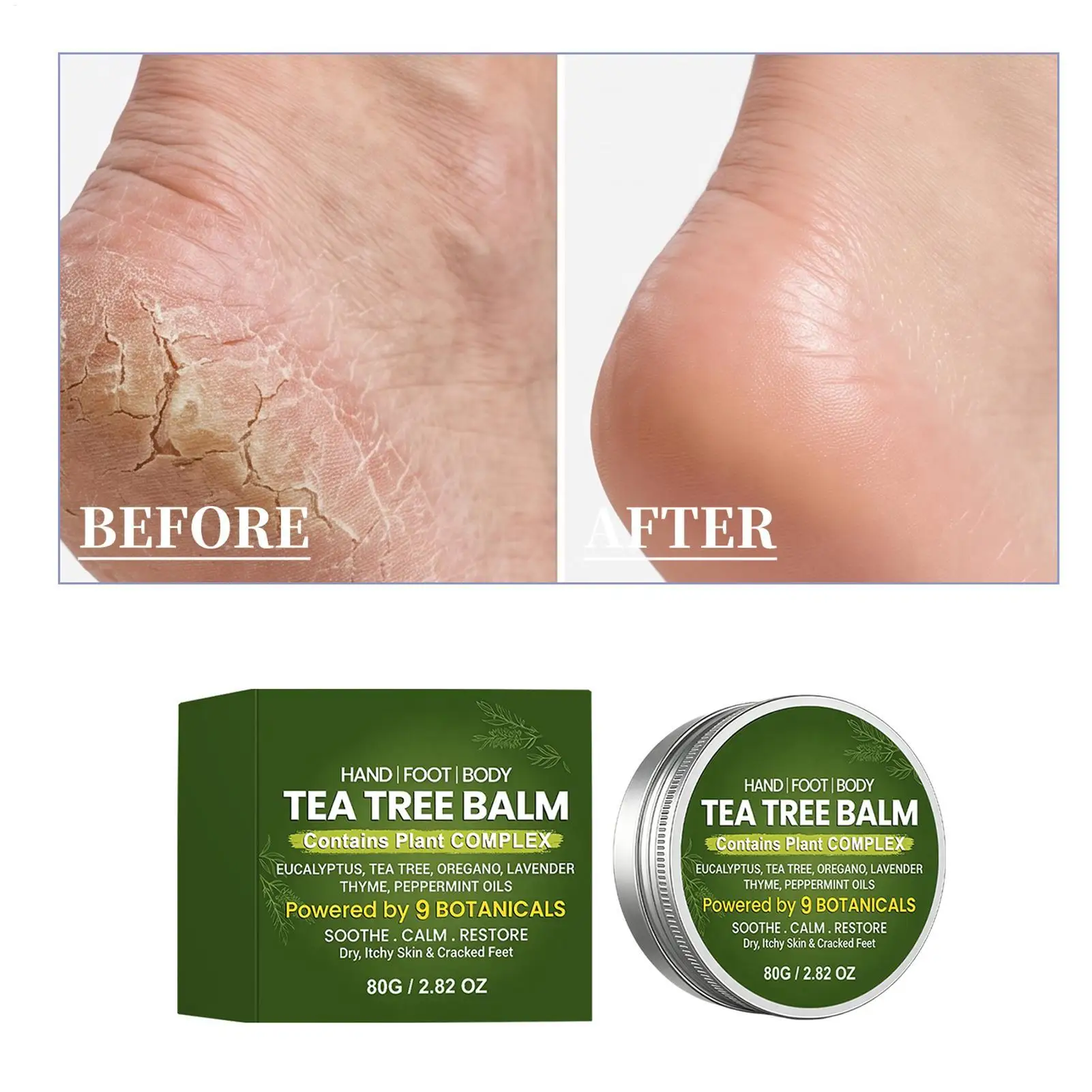 Cream for Itchy Skin 80g Moisturizing Effective Soothes Itching Lotion Skin Balm for Dry Feet Heels Hands Body Women Men Travel