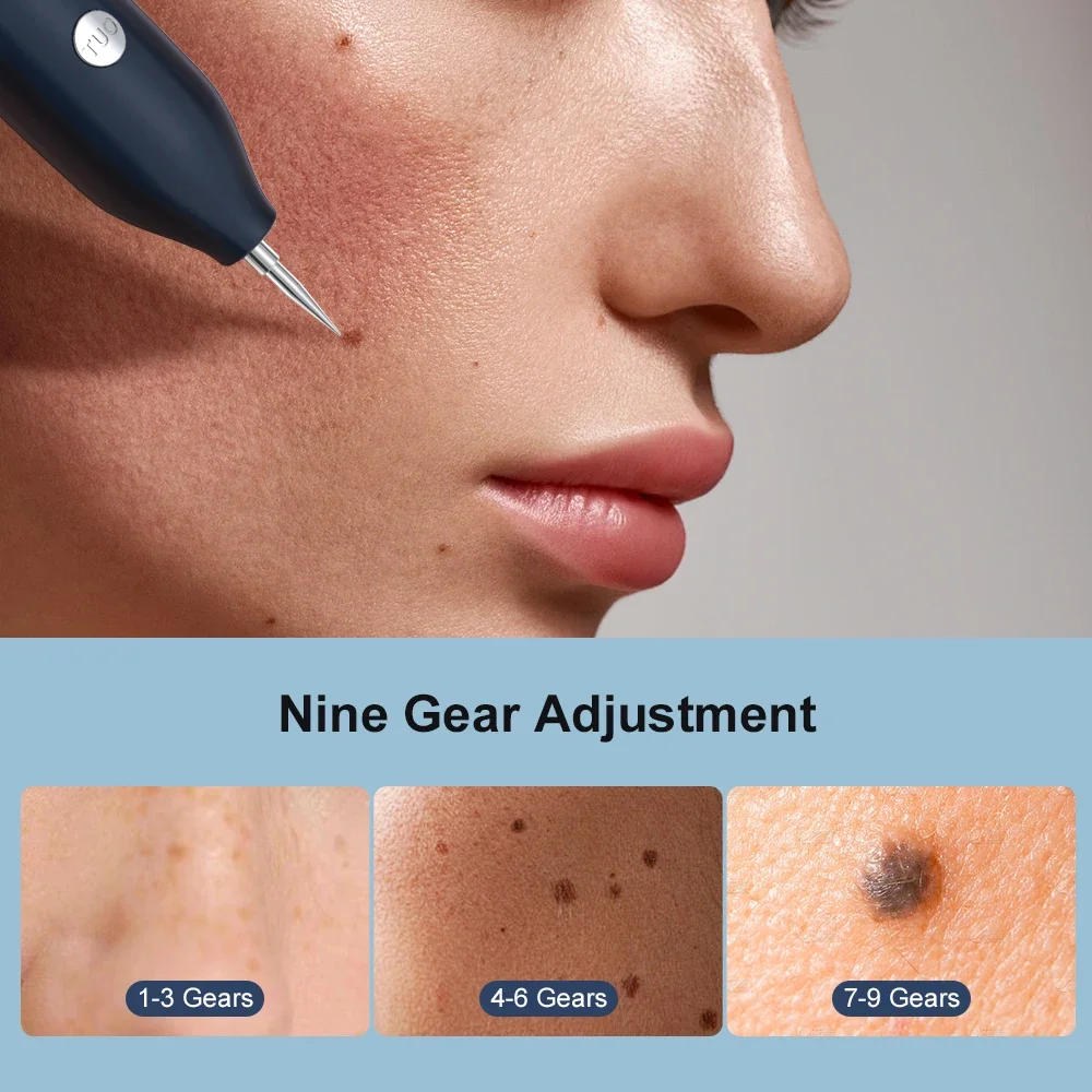 Nieuwe collectie huidoptimalisatie Pen Home Beauty Device voor vrouwen Verwijdering Spot Vermindert huidvlekken Effectief gezichtsverzorgingshulpmiddel