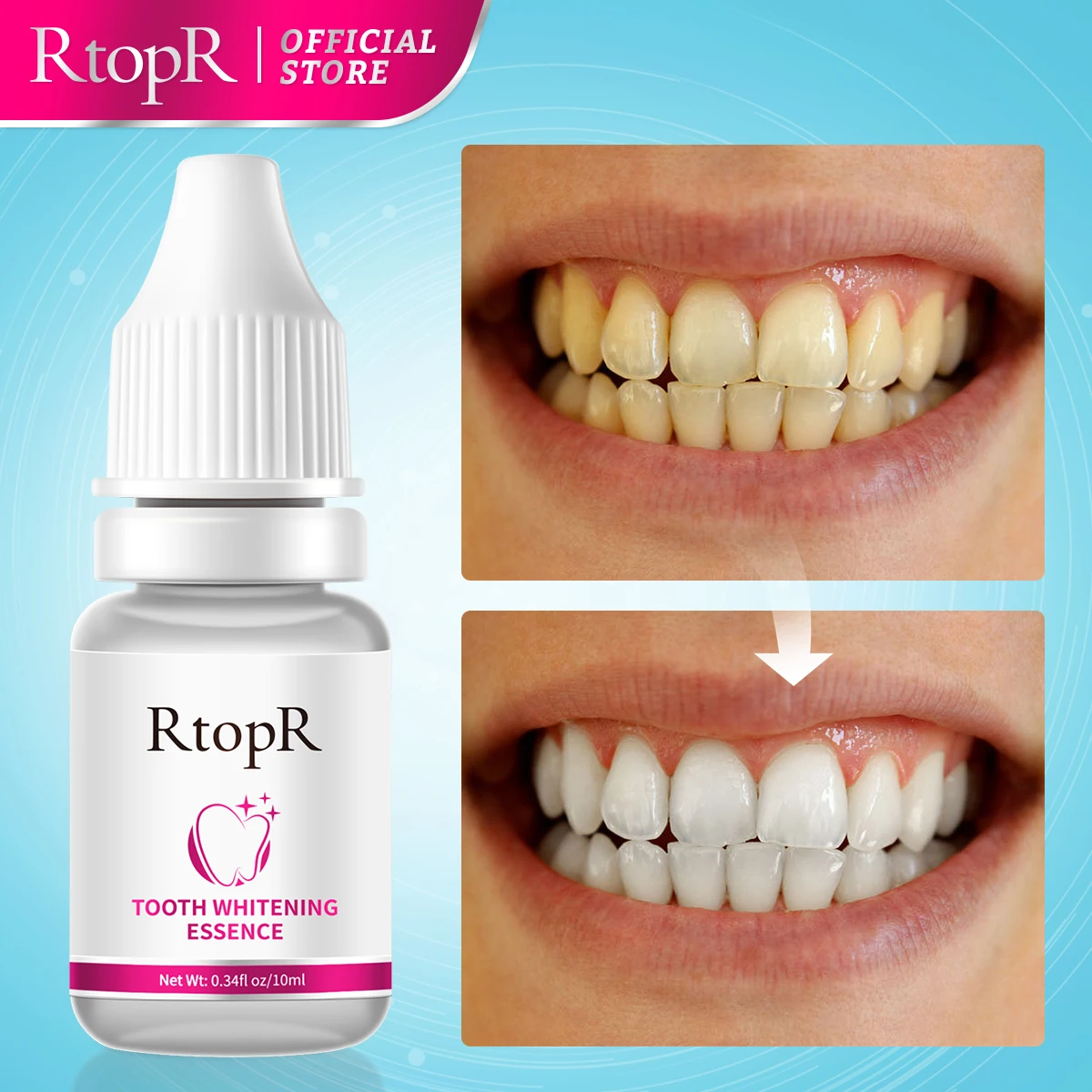 

Сыворотка для отбеливания зубов, отбеливание зубов, удаление зубов, зубной налет, улучшение желтых зубов, освежающее дыхание, чистка рта, 10 мл