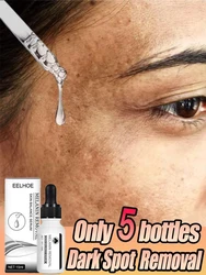 Reparación de melanina de la piel, esencia para el rostro, blanqueamiento, eliminación de manchas, suero, Retinol, vitamina C, niacinamida, aclara el cloasma, suero iluminador