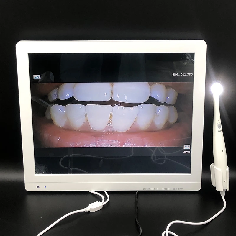 Wired Dental Intraoral Scanner, Tipo TV, Câmera Oral, Equipamentos Médicos